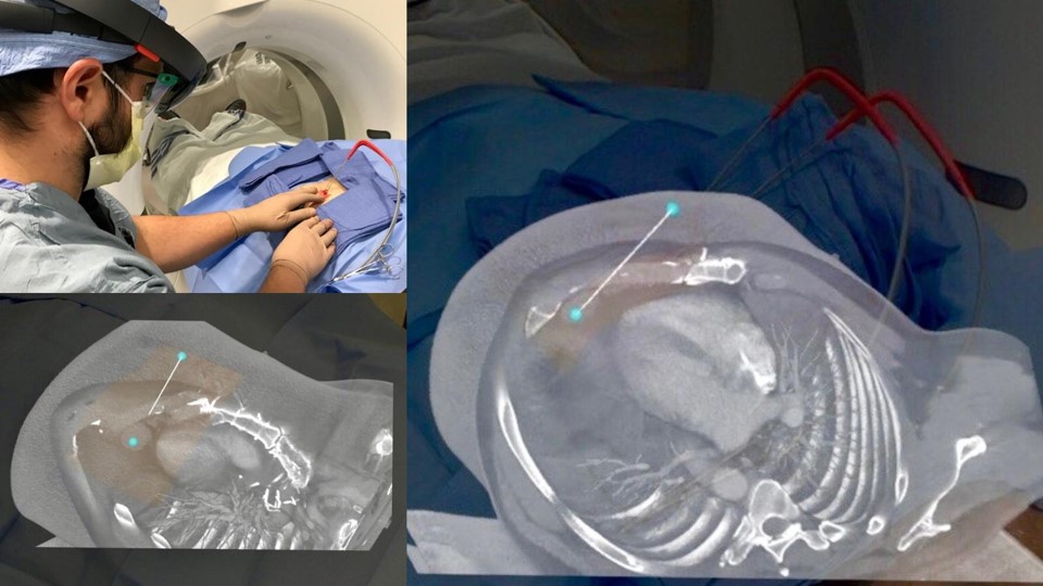 AR Surgery Guidance App